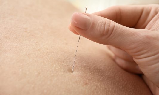 Akupunktura  w ginekologii i położnictwie praktyczny kurs